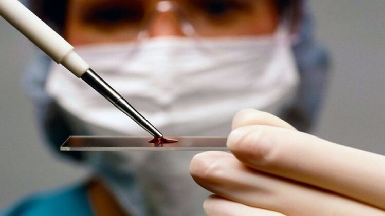 Diagnostic du virus du papillome humain